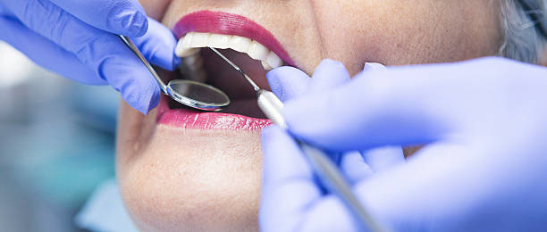 Best Broken or Cracked Tooth Emergency Dentist in Lakes West, CT